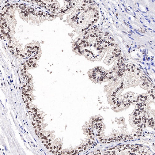 TFE3 Recombinant Rabbit mAb (SDT-760-34)