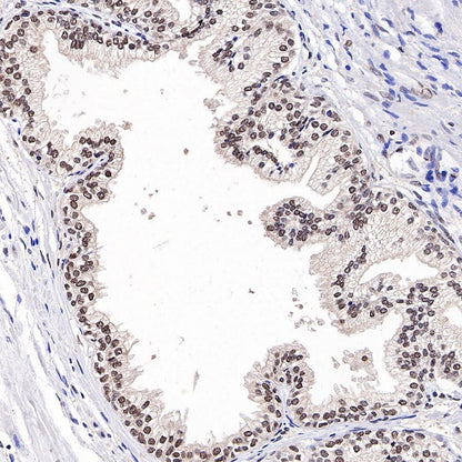 TFE3 Recombinant Rabbit mAb (SDT-760-34)