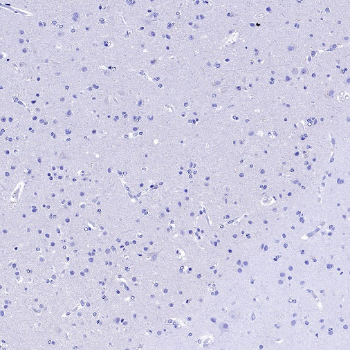 MUC5B Recombinant Rabbit mAb (SDT-2351-40)