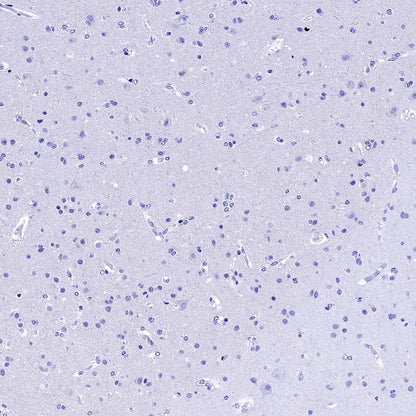 MUC5B Recombinant Rabbit mAb (SDT-2351-40)