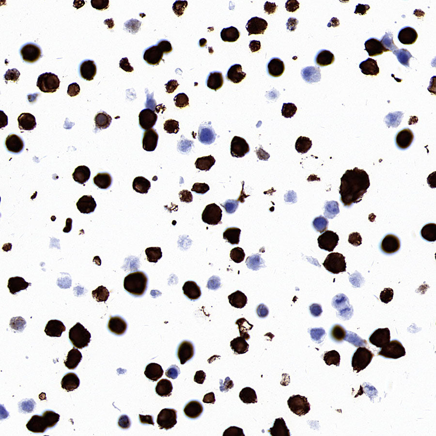STEAP1+STEAP1B1+STEAP1B2 Recombinant Rabbit mAb (S-3226-137)