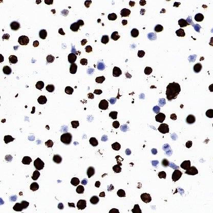 STEAP1+STEAP1B1+STEAP1B2 Recombinant Rabbit mAb (S-3226-137)