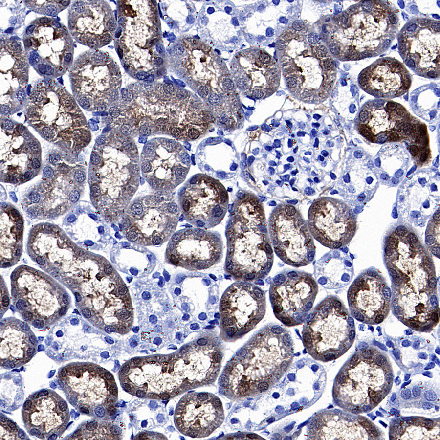 PCK1 Rabbit Polyclonal Antibody