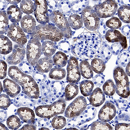 PCK1 Rabbit Polyclonal Antibody