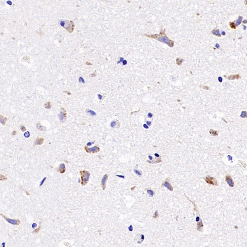 SIDT2 Recombinant Rabbit mAb (S-3763-76)