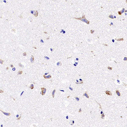 SIDT2 Recombinant Rabbit mAb (S-3763-76)