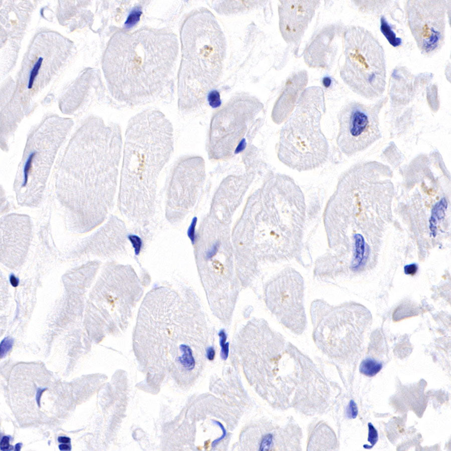 Myosin-11/SMMHC Recombinant Rabbit mAb,PBS Only (SDT-188-112)