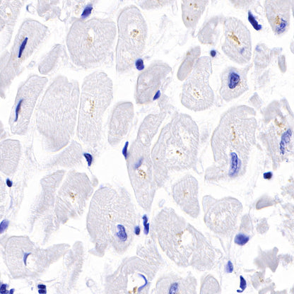 Myosin-11/SMMHC Recombinant Rabbit mAb,PBS Only (SDT-188-112)
