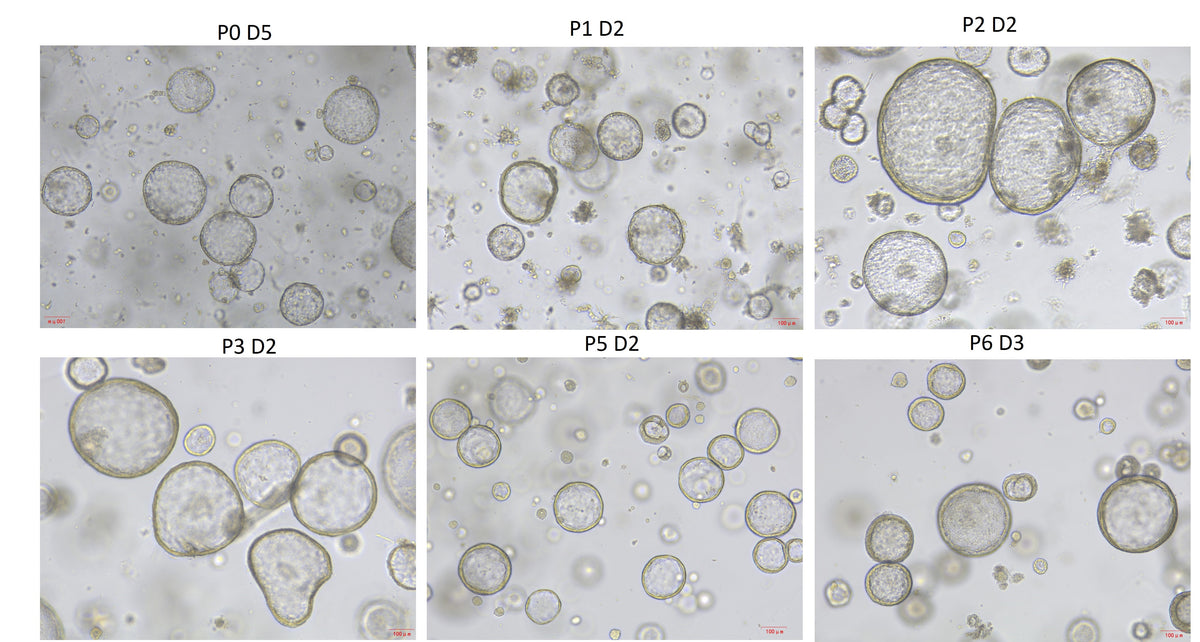 R-spondin-1 Protein, Mouse