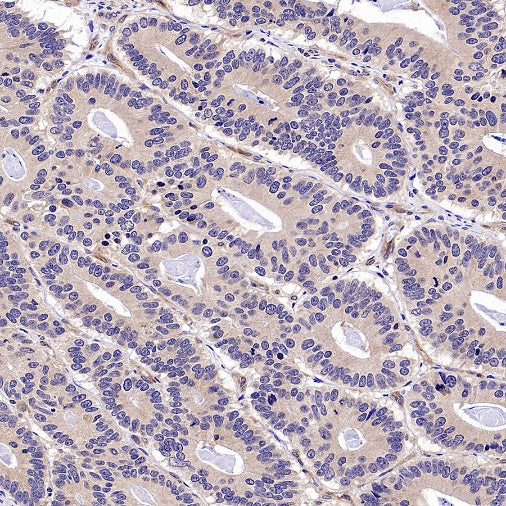 TRAF6 Recombinant Rabbit mAb (S-1087-44)