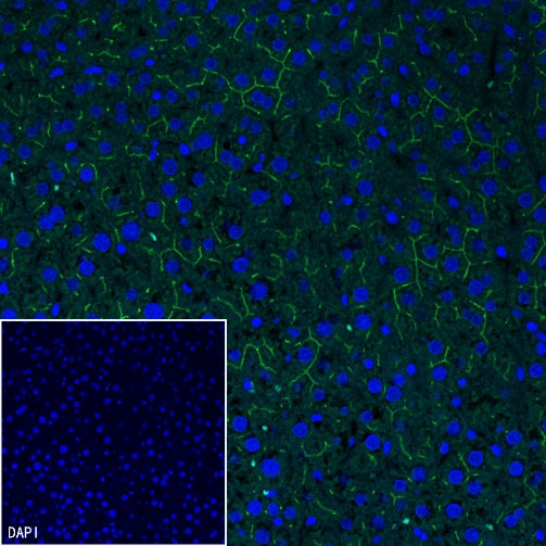 MDR3 Recombinant Rabbit mAb (SDT-1949-60)
