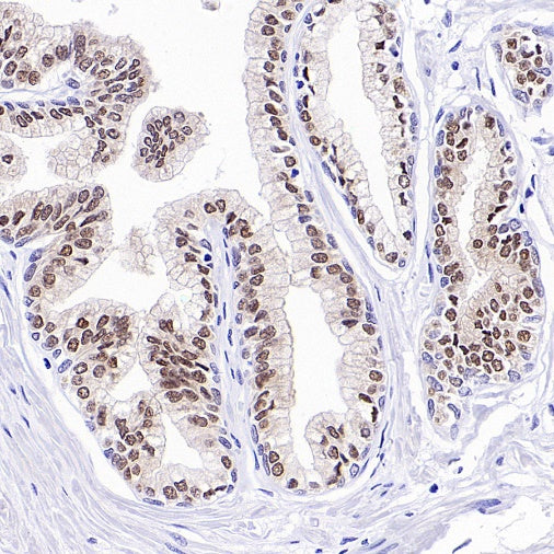 FOXA1 Recombinant Rabbit mAb, PBS Only  (SDT-2779-17)