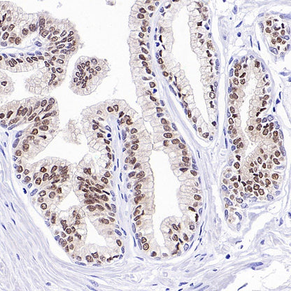 FOXA1 Recombinant Rabbit mAb, PBS Only  (SDT-2779-17)