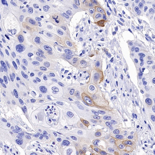 Collagen XVII Recombinant Rabbit mAb (S-1636-5)