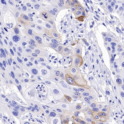 Collagen XVII Recombinant Rabbit mAb (S-1636-5)