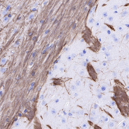 Myelin Basic Protein Recombinant Rabbit mAb (S-582-79)