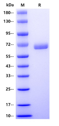 Human ALPP Protein, His tag