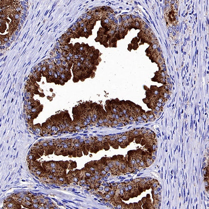 CD107b/LAMP2 Recombinant Mouse mAb (H4B4)