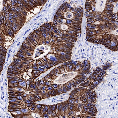 S-RMab® Cadherin 17 Recombinant Rabbit mAb (SDT-736-23)