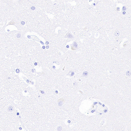 Prolactin/PRL Recombinant Rabbit mAb (S-235-215)