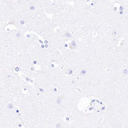 Prolactin/PRL Recombinant Rabbit mAb (S-235-215)