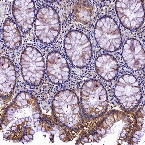 KIF5B+KIF5C Recombinant Rabbit mAb (S-2452-15)