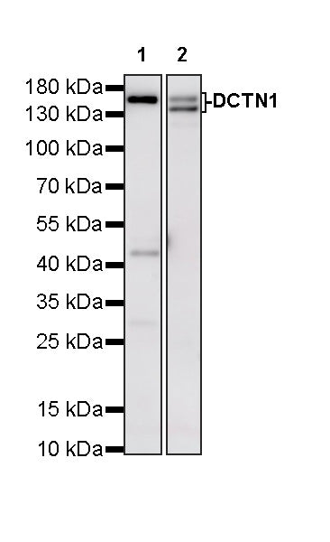 DCTN1 Rabbit Polyclonal Antibody
