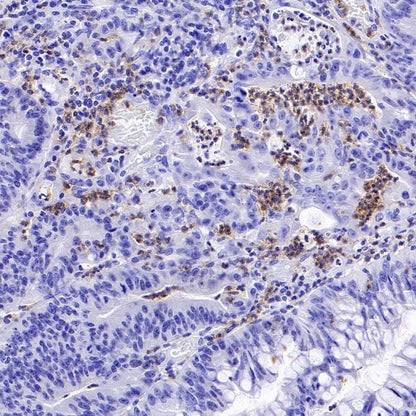 CD88 Recombinant Rabbit mAb (S-1921-43)
