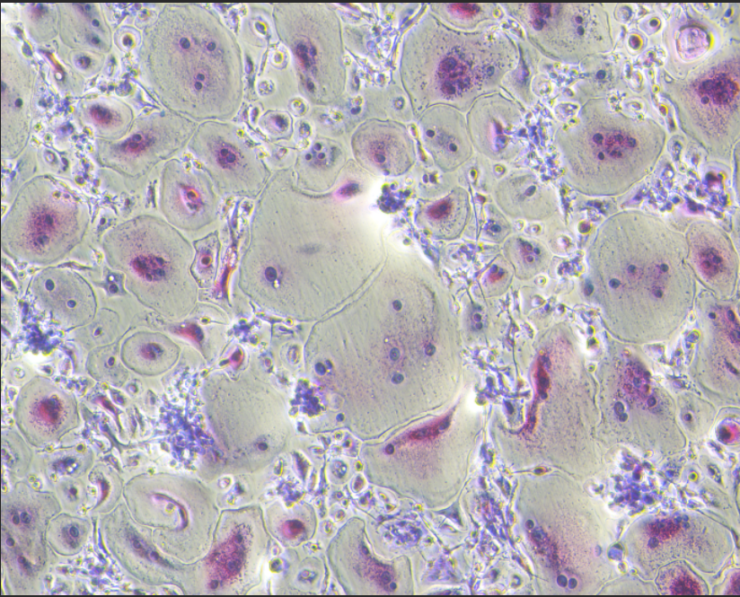 Human Monocyte-Induced Osteoclast Differentiation Cytokine Kit