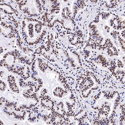 CTCF Recombinant Rabbit mAb (S-1822-42)