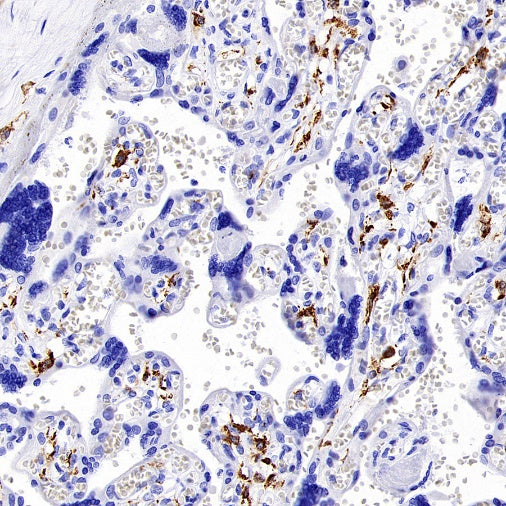 Mannose Receptor Recombinant Rabbit mAb (SDT-2206-52)
