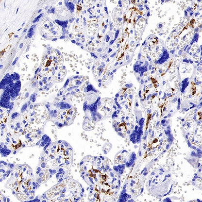 Mannose Receptor Recombinant Rabbit mAb (SDT-2206-52)