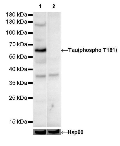 Tau (phospho T181) Recombinant Rabbit mAb (SDT-R045)
