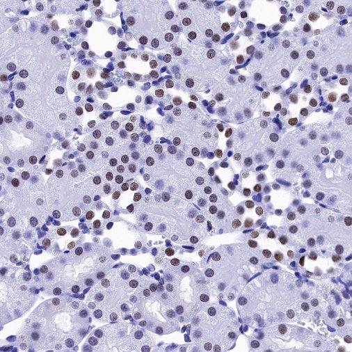 H2AFY Recombinant Rabbit mAb (S-1256-35)