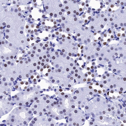 H2AFY Recombinant Rabbit mAb (S-1256-35)