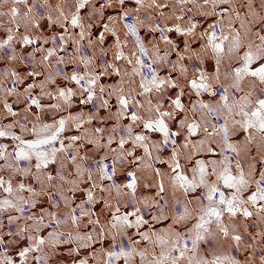N-Cadherin Recombinant Rabbit mAb (SDT-329-12)