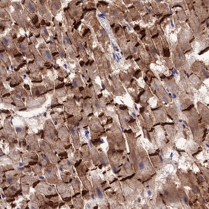 N-Cadherin Recombinant Rabbit mAb (SDT-329-12)
