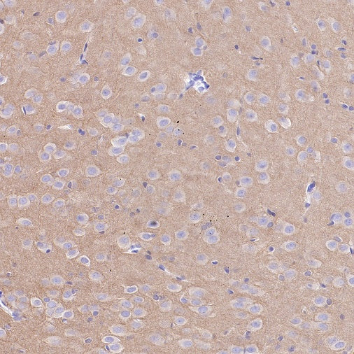 Beta I tubulin Recombinant Rabbit mAb (S-3108-63)