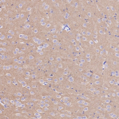 Beta I tubulin Recombinant Rabbit mAb (S-3108-63)