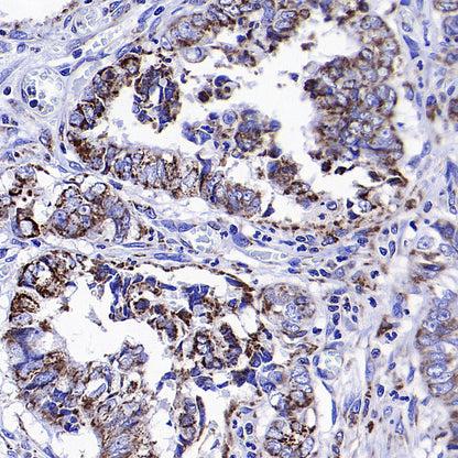 WWP1 Recombinant Rabbit mAb (S-4412-25)