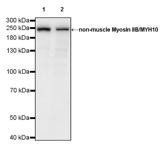 Non-muscle Myosin IIB/MYH10 Recombinant Rabbit mAb (S-299-3)