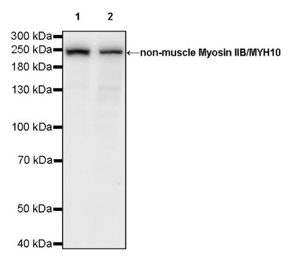 Non-muscle Myosin IIB/MYH10 Recombinant Rabbit mAb (S-299-3)