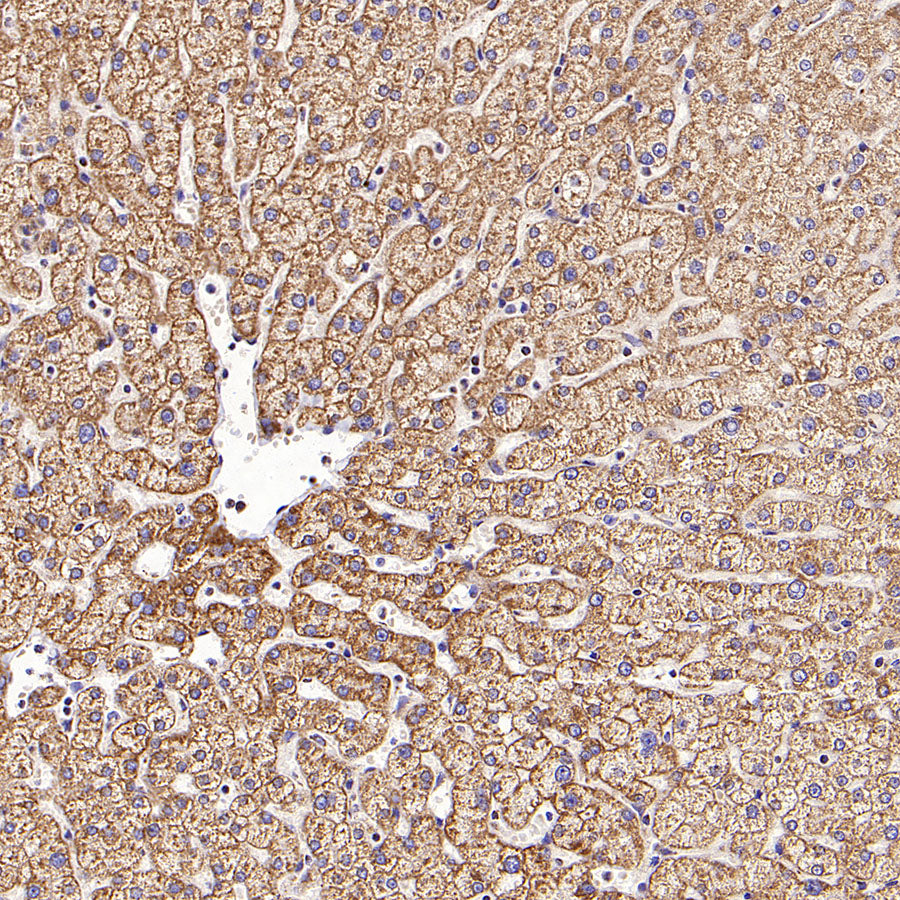 VDAC3 Rabbit Polyclonal Antibody