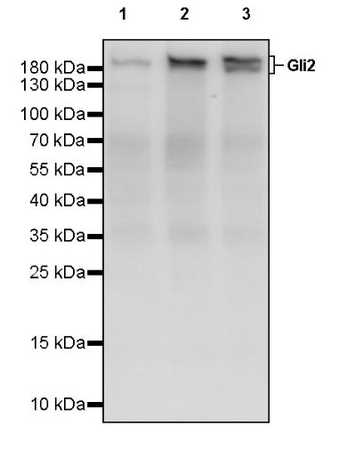 Gli2 Recombinant Rabbit mAb (S-2193-2)