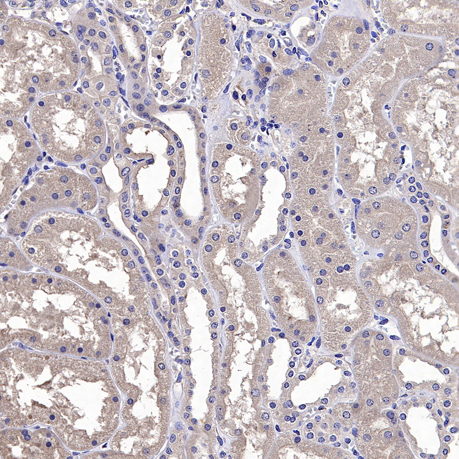 IFIH1/MDA5 Mouse mAb