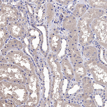 IFIH1/MDA5 Mouse mAb