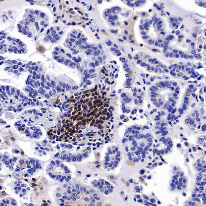 ARHGAP25 Recombinant Rabbit mAb (S-4005-5)