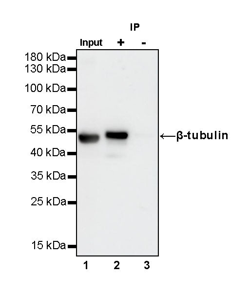 β-tubulin Recombinant Rabbit mAb (SDT-312-113)