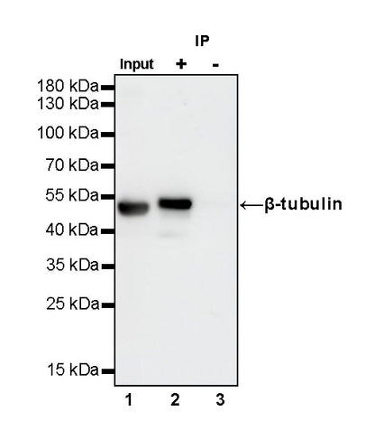β-tubulin Recombinant Rabbit mAb (SDT-312-113)