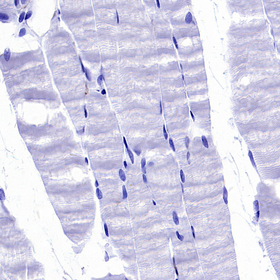 PTK7 Recombinant Rabbit mAb (SDT-2432-136)